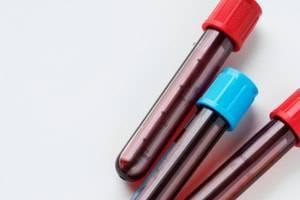 Mistakes Can Occur During DWI Blood Test Process